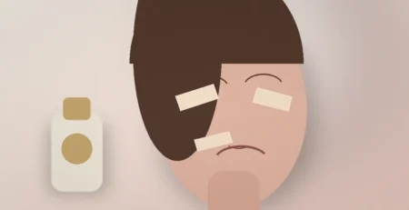 Editorial illustratie van gezichtstape op voorhoofd wangen en mondlijn