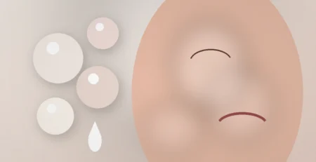 Editorial illustratie van een zachte volle en veerkrachtige Mochi Skin uitstraling